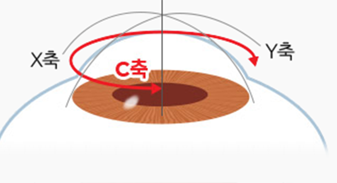 클리어뷰 스마일 라식