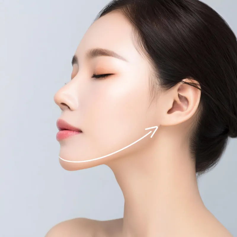 리프팅 효과 안내